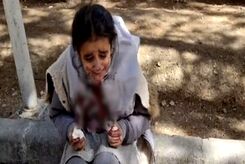 ماجرای دختر دانش‌آموز اصفهانی با صورت خون‌آلود چه بود؟+ فیلم