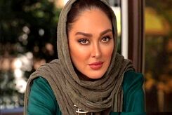 تغییر چهره الهام حمیدی همه را شوکه کرد | اضافه وزن وحشتناک الهام حمیدی برای بیماریش