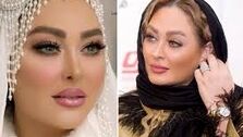تغییر چهره باورنکردنی الهام حمیدی| عکس دیده نشده