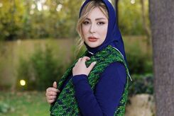 صورت زخم و کبود نیوشا ضیغمی