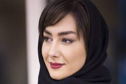 عکس هانیه توسلی قبل از عمل زیبایی+عکس دیده نشده 