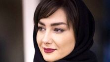 عکس هانیه توسلی قبل از عمل زیبایی+عکس دیده نشده 