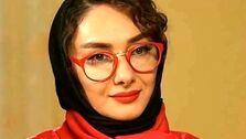 هانیه توسلی بعد از شیمی درمانی+عکس