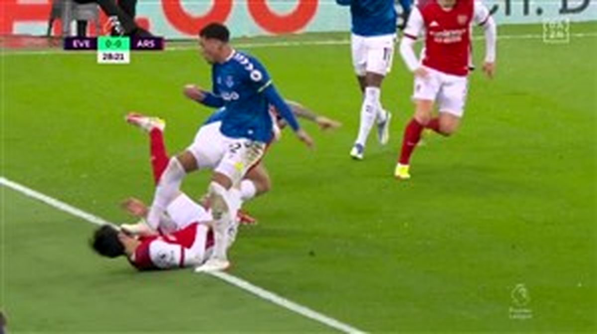 نوازش صورت کاکرو با میخ استوک (عکس)