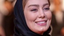 اسیدپاشی به صورت سحر قریشی در دبی توسط هواداران تتلو | صورت سحر قریشی داغون شد