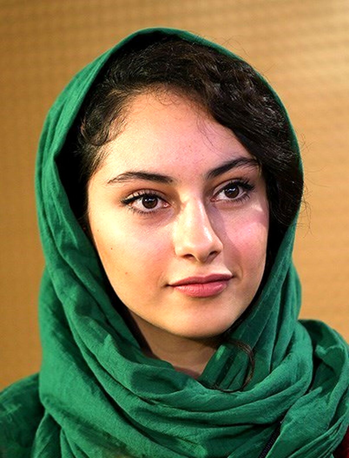 سر و صورت خونی ترلان پروانه | کتک کاری ترلان پروانه کار دستش داد