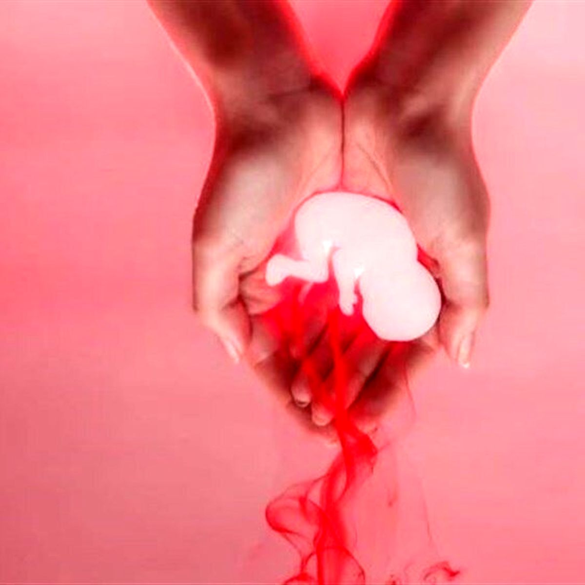 انجام روزانه ۱۳۰۰ سقط جنین غیرقانونی در ایران